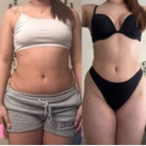 ¡Solo por Black Friday! 🍎 Paga 1 y recibe 2 Gomitas de Vinagre – Pocas unidades